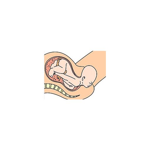 EPI • NO®  Delphine