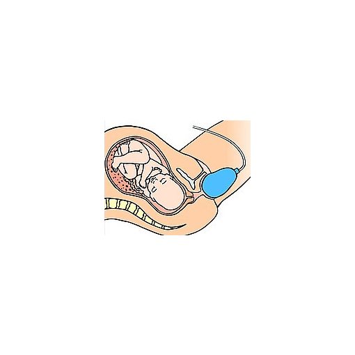 EPI • NO®  Delphine plusz 